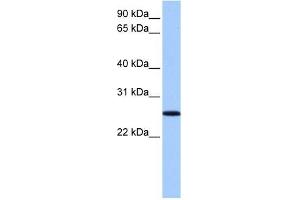 FBXO36 antibody used at 1 ug/ml to detect target protein.