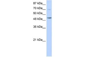 WB Suggested Anti-IKZF3 Antibody Titration:  0. (IKZF3 anticorps  (N-Term))