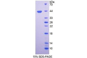 SDS-PAGE analysis of Human CTBS Protein. (CTBS Protéine)