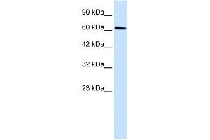 WB Suggested Anti-UBP1 Antibody Titration:  0. (UBP1 anticorps  (Middle Region))