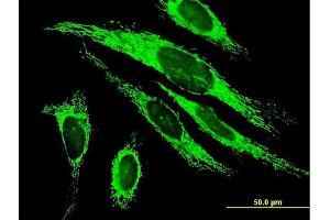 Immunofluorescence of purified MaxPab antibody to MRPS27 on HeLa cell.