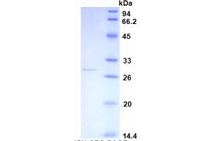 SDS-PAGE of Protein Standard from the Kit (Highly purified E. (CRP Kit ELISA)