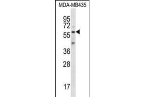 FSCN3 Antibody (C-term) (ABIN657009 and ABIN2846189) western blot analysis in MDA-M cell line lysates (35 μg/lane). (Fascin 3 anticorps  (C-Term))