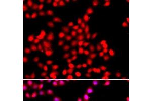 Immunofluorescence analysis of A549 cells using TTBK2 Polyclonal Antibody (TTBK2 anticorps)