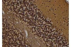ABIN6269402 at 1/100 staining Rat brain tissue by IHC-P. (DARPP32 anticorps)