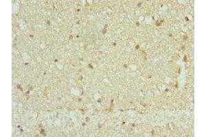 Immunohistochemistry of paraffin-embedded human brain tissue using ABIN7146447 at dilution of 1:100