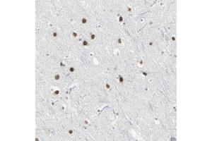 Immunohistochemical staining (Formalin-fixed paraffin-embedded sections) of human cerebral cortex with ZIC1 polyclonal antibody  shows strong nuclear positivity in neuronal and glial cells. (ZIC1 anticorps)