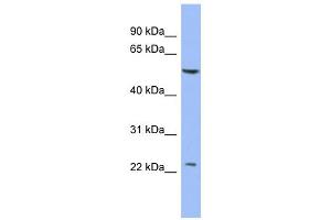 WB Suggested Anti-PABPC1L2A Antibody Titration:  0. (PABPC1L2A anticorps  (Middle Region))