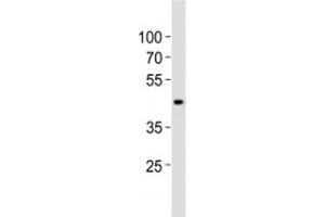 Western blot analysis of lysate from human kidney tissue lysate using SOX7 antibody diluted at 1:1000. (SOX7 anticorps  (AA 224-258))