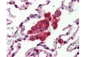 Anti-Clusterin antibody IHC of human lung. (Clusterin anticorps  (AA 1-333))