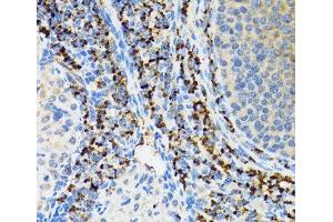 Immunohistochemistry of paraffin-embedded Rat ovary using SRP19 Polyclonal Antibody at dilution of 1:100 (40x lens). (SRP19 anticorps)