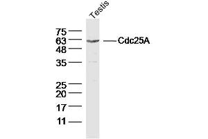 Mouse Testis lysates probed with Cdc25A Polyclonal Antibody, Unconjugated  at 1:300 dilution and 4˚C overnight incubation. (CDC25A anticorps  (AA 451-524))
