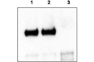 Mouse cortex lysate was immunoprecipitated with anti-TrkCT1 antibody and further blotted with affinity purified anti-TrkCT1.