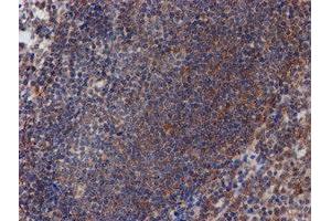 Image no. 13 for anti-ATR Interacting Protein (ATRIP) (AA 42-309) antibody (ABIN1491507)