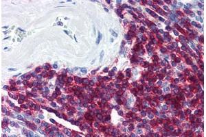 Human Spleen (formalin-fixed, paraffin-embedded) stained with CD5 antibody ABIN298515 at 20 ug/ml followed by biotinylated anti-mouse IgG secondary antibody ABIN481714, alkaline phosphatase-streptavidin and chromogen. (CD5 anticorps)