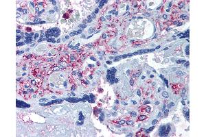 Anti-ADAMTS5 antibody IHC of human placenta. (ADAMTS5 anticorps  (Internal Region))