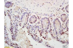 Formalin-fixed and paraffin embedded mouse intestine labeled with Rabbit Anti MSH2 Polyclonal Antibody, Unconjugated (ABIN672816) at 1:200 followed by conjugation to the secondary antibody and DAB staining