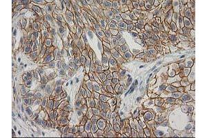 Image no. 1 for anti-Catenin (Cadherin-Associated Protein), beta 1, 88kDa (CTNNB1) antibody (ABIN1496888)