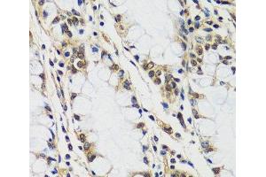 Immunohistochemistry of paraffin-embedded Human colon using CASC5 Polyclonal Antibody at dilution of 1:100 (40x lens). (CASC5 anticorps)