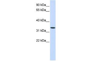WB Suggested Anti-WNT6 Antibody Titration:  0. (WNT6 anticorps  (Middle Region))