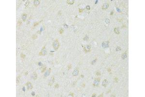 Immunohistochemistry of paraffin-embedded Rat brain using SLC22A5 Polyclonal Antibody at dilution of 1:100 (40x lens).