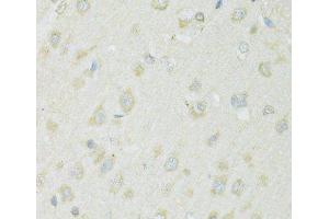 Immunohistochemistry of paraffin-embedded Rat brain using SLC22A5 Polyclonal Antibody at dilution of 1:100 (40x lens). (SLC22A5 anticorps)