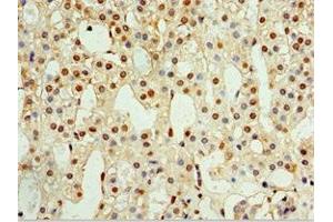 Immunohistochemistry of paraffin-embedded human adrenal gland tissue using ABIN7146290 at dilution of 1:100 (CALCB anticorps  (AA 1-127))