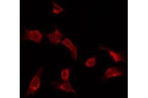 ABIN6275733 staining HepG2 by IF/ICC. (RNF113B anticorps  (Internal Region))