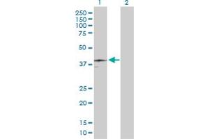 Western Blot analysis of HFE expression in transfected 293T cell line by HFE MaxPab polyclonal antibody. (HFE anticorps  (AA 1-348))