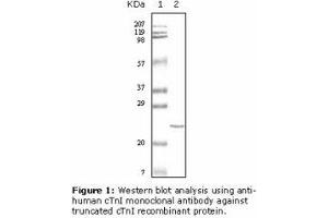 Image no. 2 for anti-Cardiac Troponin I (TNNI3) antibody (ABIN232097) (TNNI3 anticorps)