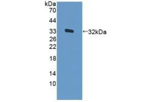 Detection of Recombinant PKR, Human using Polyclonal Antibody to Protein Kinase R (PKR) (EIF2AK2 anticorps  (AA 224-502))