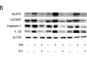 Effects of PU on mitochondrion injury and pyroptosis of the diabetic mice's kidneys.