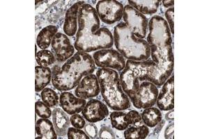 Immunohistochemical staining of human kidney with CD34 polyclonal antibody  shows strong cytoplasmic positivity in cells of tubules at 1:50-1:200 dilution. (CDC34 anticorps)