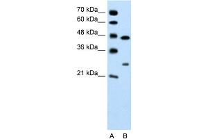 WB Suggested Anti-CLDN18 Antibody Titration: 0. (Claudin 18 anticorps  (C-Term))