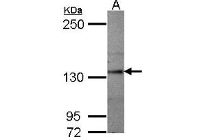 Western Blotting (WB) image for anti-Sema Domain, Seven thrombospondin Repeats (Type 1 and Type 1-Like), Transmembrane Domain (TM) and Short Cytoplasmic Domain, (Semaphorin) 5A (SEMA5A) (AA 700-1000) antibody (ABIN1501911) (SEMA5A anticorps  (AA 700-1000))