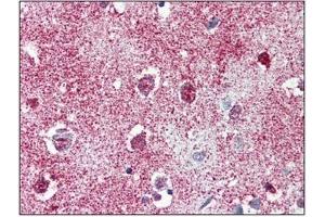 Immunohistochemistry: TAOK1 antibody staining of Formalin-Fixed, Paraffin-Embedded Human Brain, Cortex. (TAO Kinase 1 (TAOK1) (C-Term) anticorps)