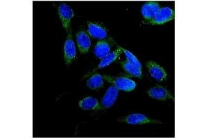 anti-Folliculin (FLCN) (AA 8-551) antibody