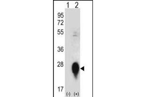 Western blot analysis of CLEC3B (arrow) using rabbit polyclonal CLEC3B Antibody (Center) (ABIN656570 and ABIN2845832). (CLEC3B anticorps  (AA 95-122))