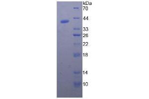 SDS-PAGE analysis of Pig BNP. (Brain Natriuretic Peptide (BNP) Peptide)
