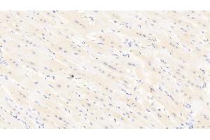 Detection of LEPR in Human Cardiac Muscle Tissue using Polyclonal Antibody to Leptin Receptor (LEPR)