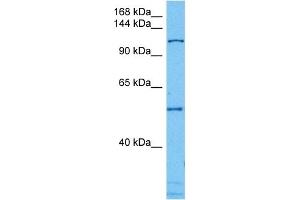 Host:  Mouse  Target Name:  CAND1  Sample Tissue:  Mouse Testis  Antibody Dilution:  1ug/ml (CAND1 anticorps  (N-Term))