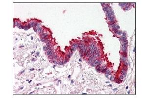 Image no. 1 for anti-SKI-Like Oncogene (SKIL) (N-Term) antibody (ABIN303248) (SKIL anticorps  (N-Term))