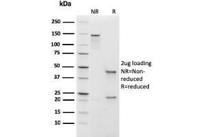 SDS-PAGE Analysis Purified IgM Recombinant Mouse Monoclonal Antibody (rIGHM/1623). (Recombinant IGHM anticorps)