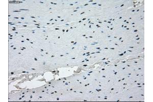 Immunohistochemical staining of paraffin-embedded endometrium tissue using anti-KDM4C mouse monoclonal antibody. (KDM4C anticorps)