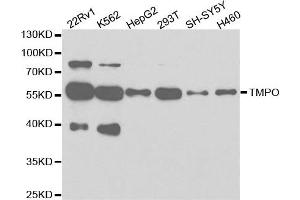 Western Blotting (WB) image for anti-Thymopoietin (TMPO) antibody (ABIN1875122) (Thymopoietin anticorps)