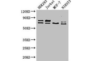 Western Blot Positive WB detected in: HEK293 whole cell lysate, Jurkat whole cell lysate, MCF-7 whole cell lysate, NIH/3T3 whole cell lysate All lanes: NF2 antibody at 2.
