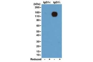 Western blot of nonreduced(-) and reduced(+) mouse IgG1, kappa and IgG1, lambda (20ng/lane), using 0. (Recombinant Lapin anti-Souris lambda Light Chain (Lambda-IgLC) Anticorps)
