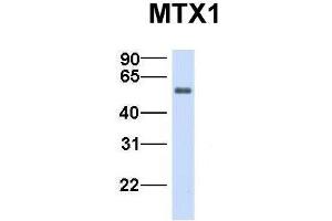 Host:  Rabbit  Target Name:  MTX1  Sample Type:  Human Fetal Heart  Antibody Dilution:  1. (Metaxin 1 anticorps  (C-Term))