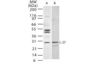 Image no. 1 for anti-Interleukin 27 (IL27) (AA 31-46) antibody (ABIN208552)