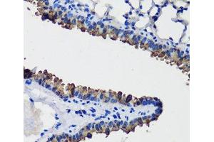 Immunohistochemistry of paraffin-embedded Mouse lung using SCGB1A1 Polyclonal Antibody at dilution of 1:100 (40x lens). (SCGB1A1 anticorps)
